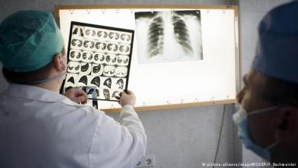 ВООЗ назвала туберкульоз найбільш смертоносною хворобою в світі
