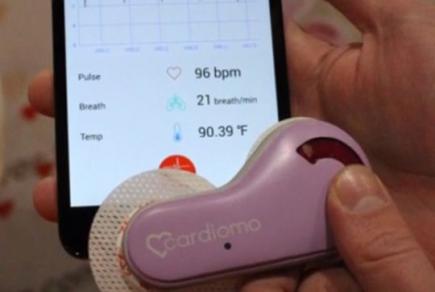 Українець створив кардіомонітор, що передає дані на смартфон