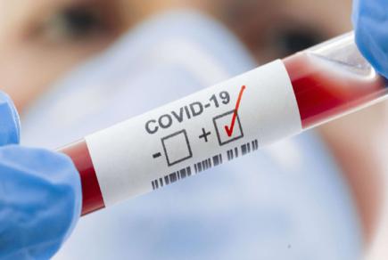 Чи може COVID-19 бути визнаним професійним захворюванням?