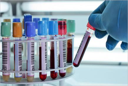 У столиці роботодавцям рекомендовано тестувати працівників на антитіла до коронавірусу
