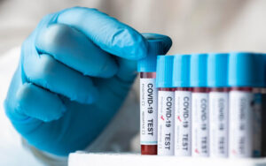 Новий штам коронавірусу «Pirola»: чи загрожує він Україні